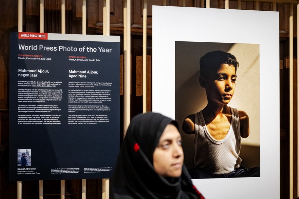 Fotógrafa palestina vence World Press Photo 2025 com retrato de menino que perdeu os dois braços em bombardeio
